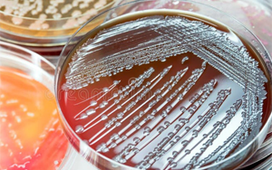 島津AccuDia培養(yǎng)基系列：提供完整的細(xì)胞培養(yǎng)與微生物檢測(cè)解決方案?