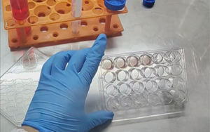 精準(zhǔn)營養(yǎng)，塑造未來：類器官培養(yǎng)基的新紀(jì)元