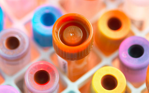 總蛋白（TP）檢測試劑盒用原輔料