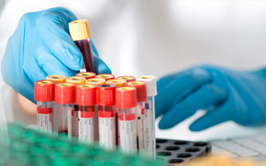 血氨（BA）檢測(cè)試劑盒用原輔料