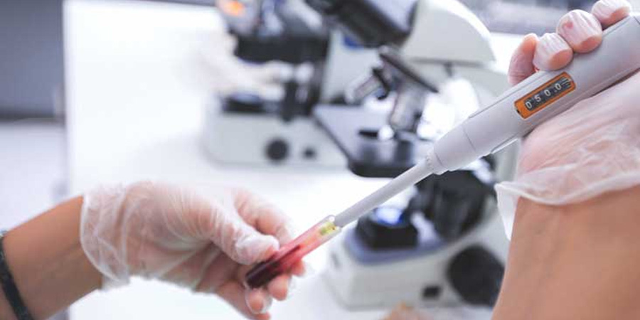 肌紅蛋白(MYO)檢測(cè) 肌紅蛋白(MYO)檢測(cè)