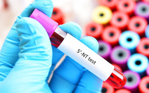 5'-核苷酸酶（5'-NT）檢測(cè)試劑盒用原輔料