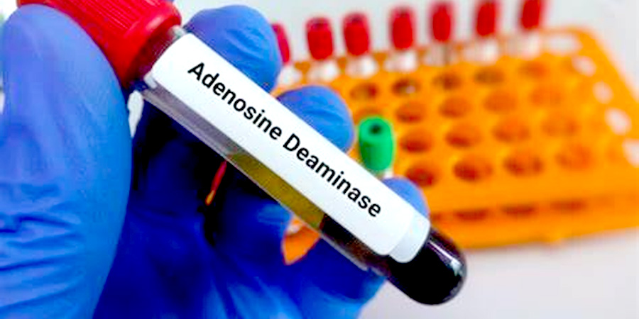 前蛋白檢測(cè) 前蛋白檢測(cè)