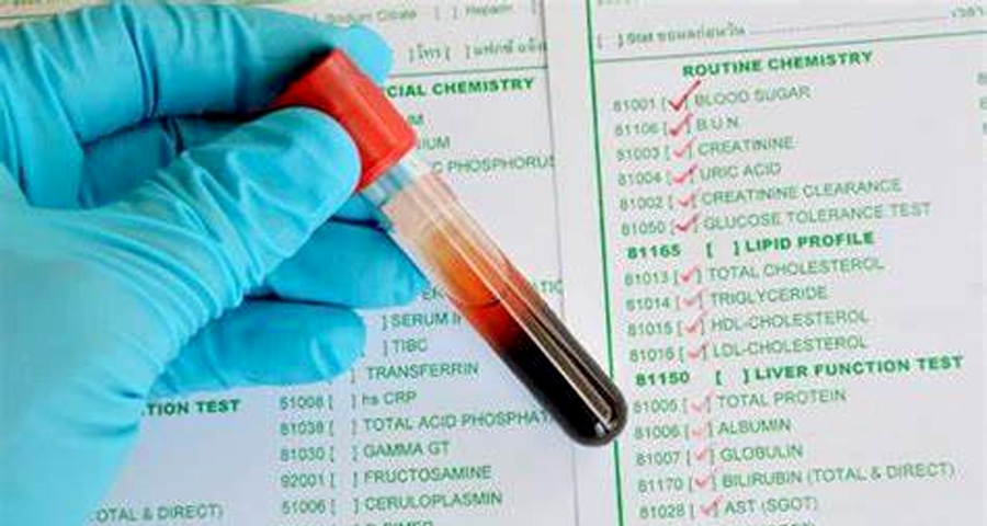 單胺氧化酶(MAO)檢測 單胺氧化酶(MAO)檢測