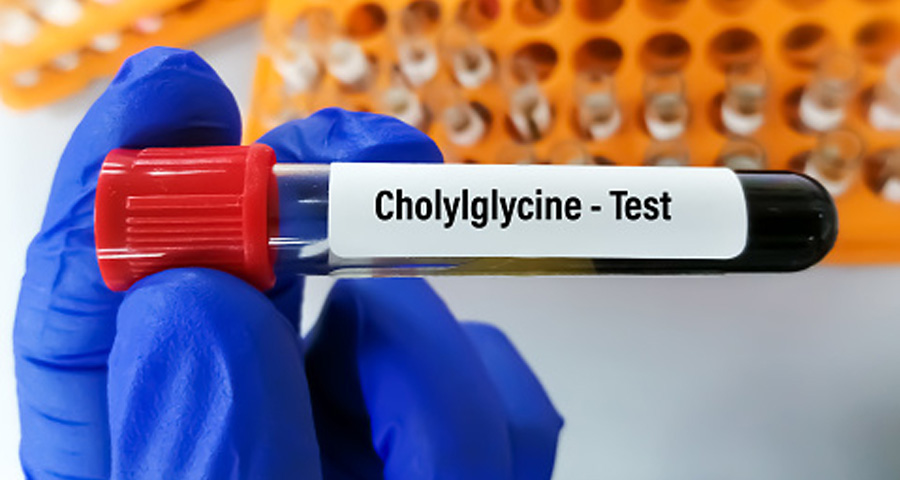 總膽汁酸（TBA）檢測(cè)