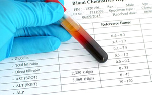 谷丙轉(zhuǎn)氨酶（ALT）檢測試劑盒用原輔料