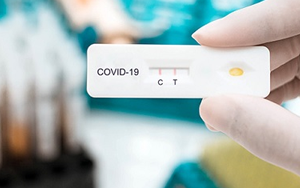 新冠(2019-nCoV)抗原檢測(cè)解決方案