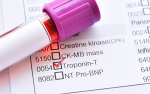 心肌肌鈣蛋白T（cTnT）-磁微?；瘜W(xué)發(fā)光法（吖啶酯） /熒光免疫層析解決方案