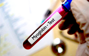 肌紅蛋白（Myo）-磁微?；瘜W(xué)發(fā)光（AE/AP） /熒光免疫層析解決方案