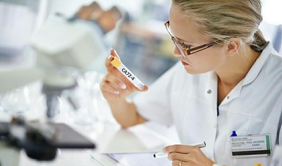 糖類抗原72-4（CA72-4）-磁微?；瘜W(xué)發(fā)光（吖啶酯）
解決方案